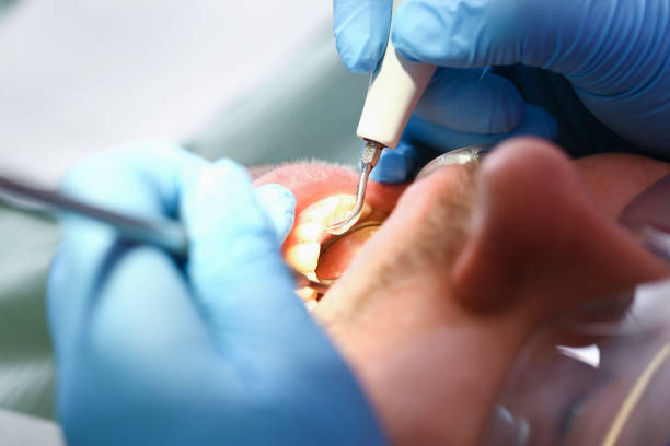 Best Emergency Dental Services for Seniors in Loveland Park, OH