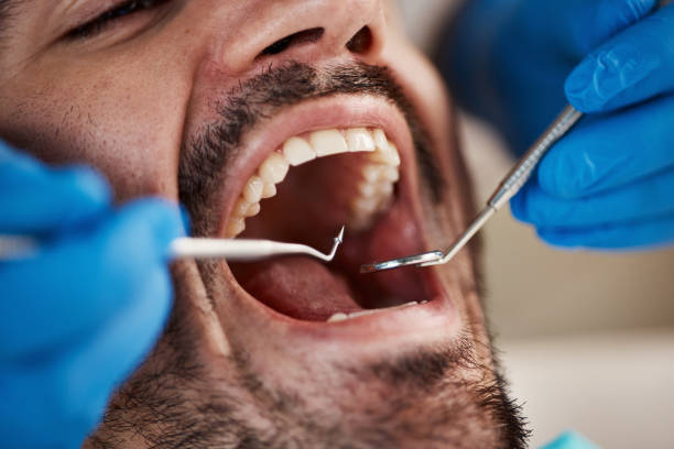 Best Emergency Dentist for Lost Fillings or Crowns in Loveland Park, OH