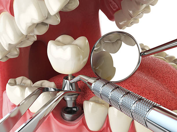 Best Broken or Cracked Tooth Emergency Dentist in Loveland Park, OH